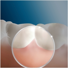Oral-B Aufsteckdüsen Oxyjet - 4er
